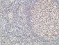 Bcl-6 Polyclonal Antibody